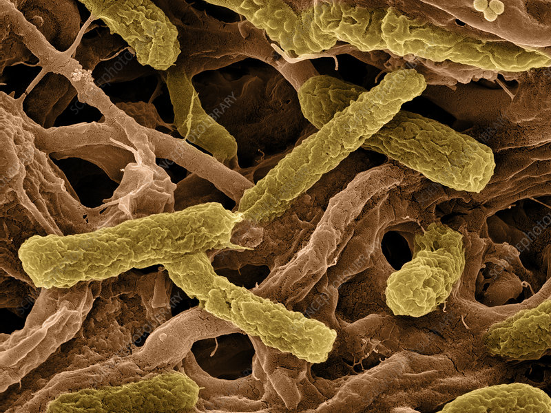 Compostaje acelerado por bacterias termófilas, transformar residuos orgánicos masivos en abono rico en solo 72 horas